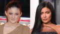 Celebrities Who Admit They've Had Work Done Over the Years — Kylie Jenner, Chrissy Teigen and More