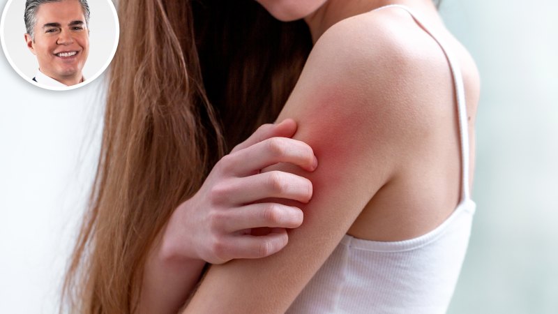 How to Get Rid of Heat Rash Quickly, According to Dermatologists