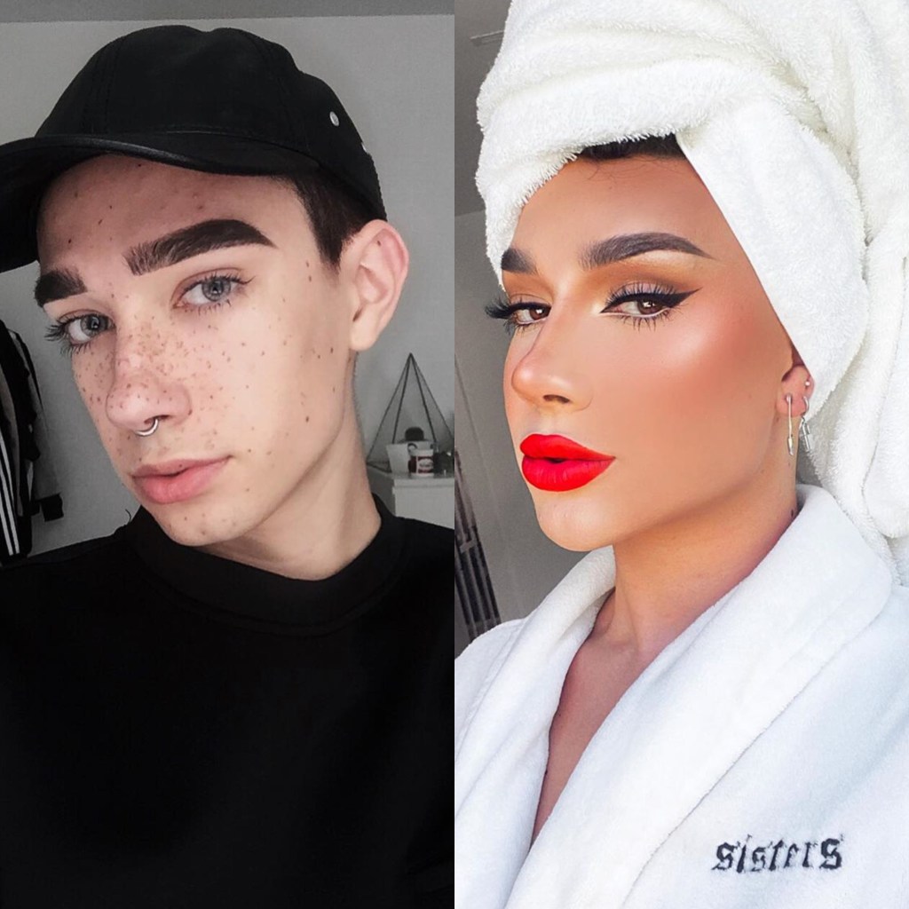 James Charles Plastic Surgery Youtuber Reveals Procedures