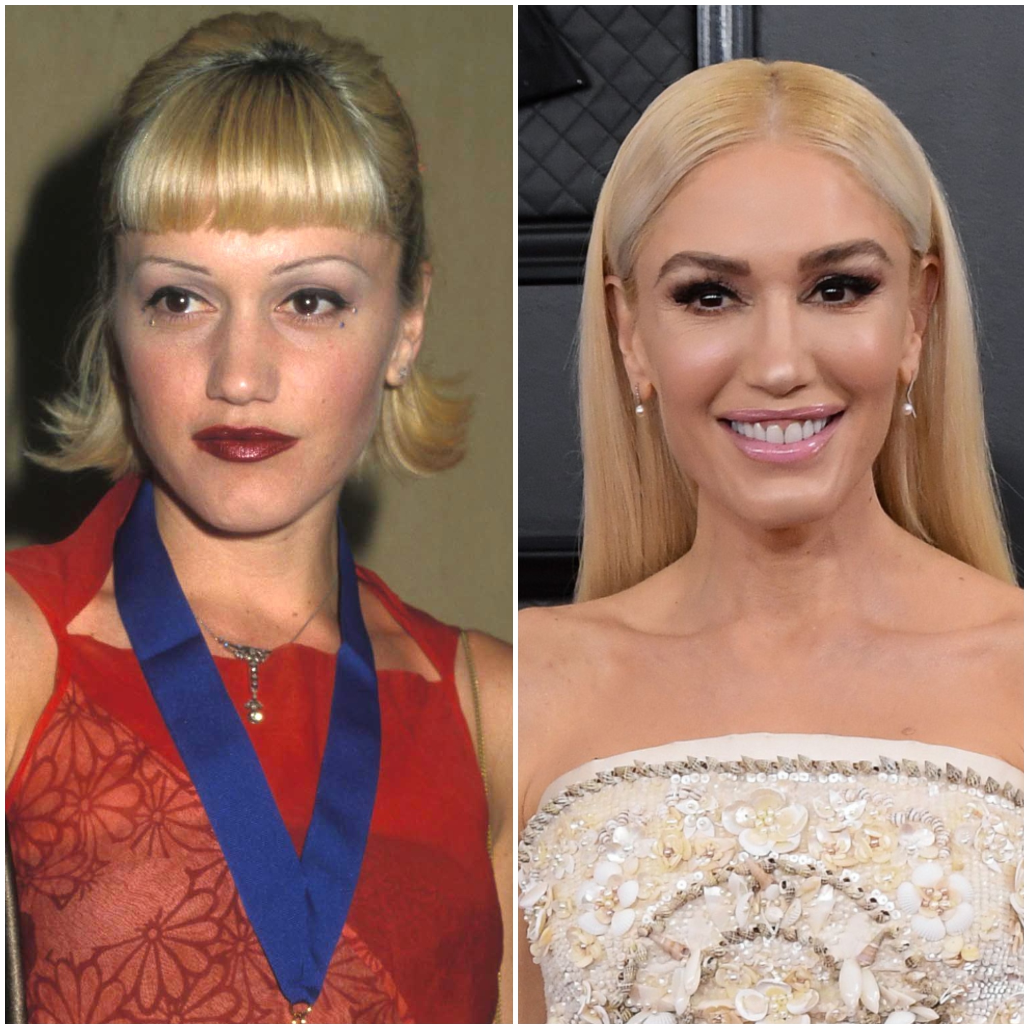 Has Gwen Stefani Had Plastic Surgery See What Experts Think   Gwen Stefani Transformation Plastic Surgery Speculation 