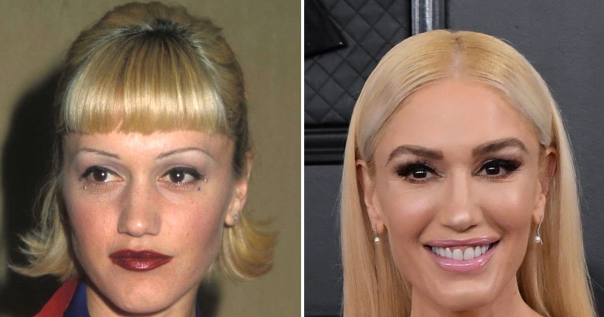 Has Gwen Stefani Had Plastic Surgery See What Experts Think