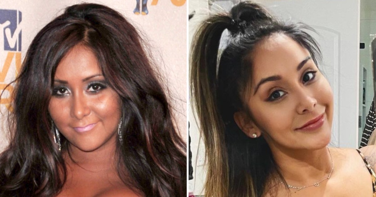 Snooki's Plastic Surgery Transformation Before and After Photos