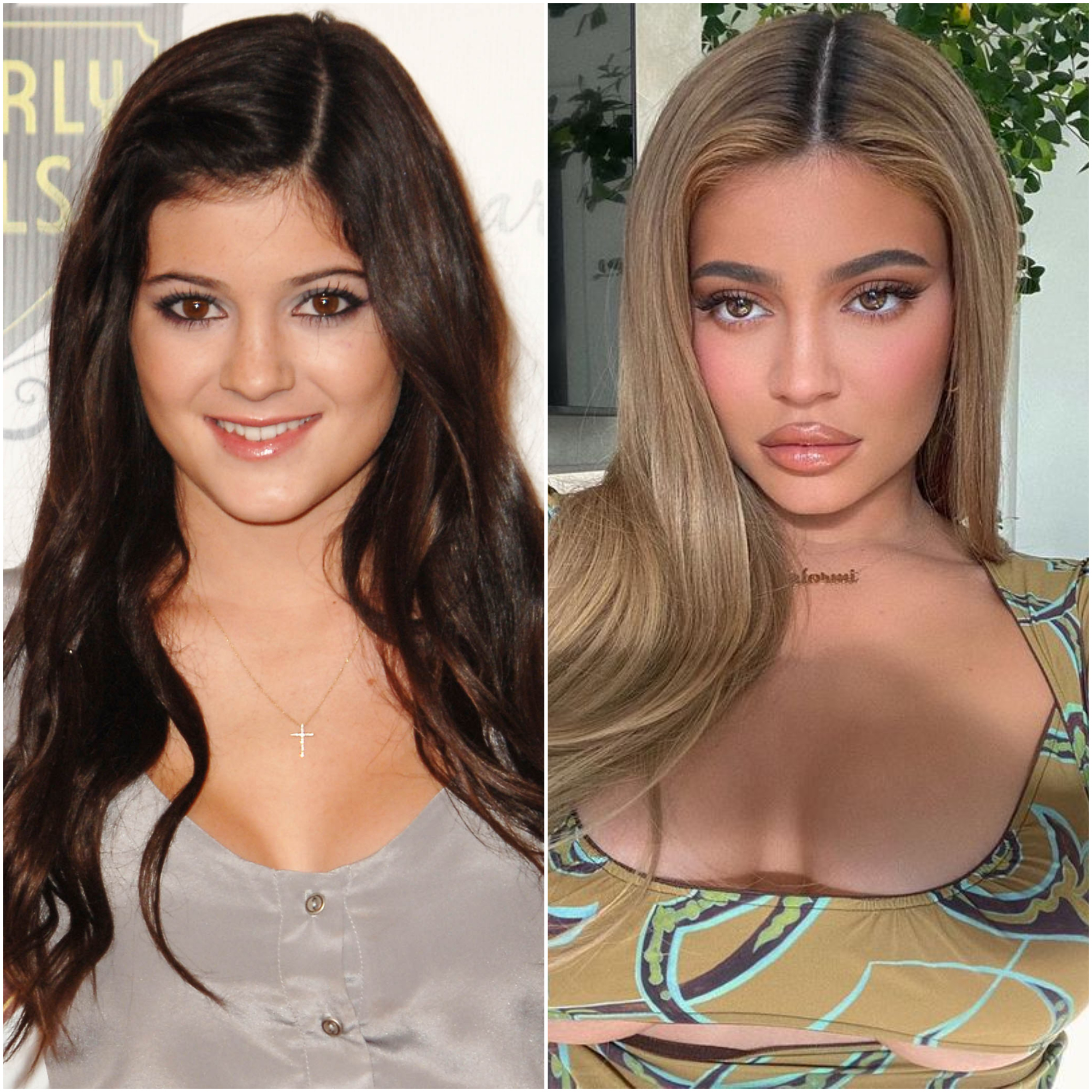 Kylie Jenner Transformation Photos See How She S Changed