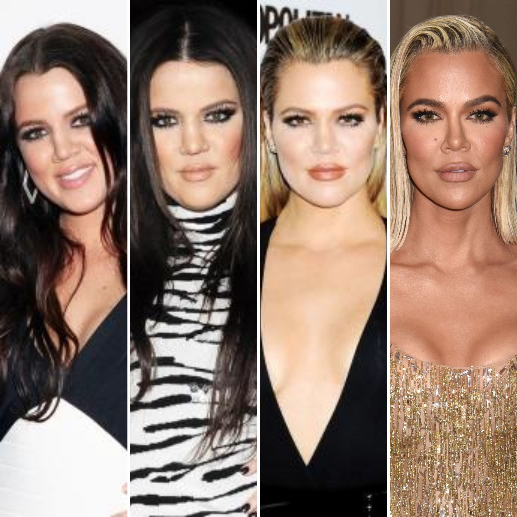 Kardashian-Jenners Plastic Surgery: Before and After Photos | Life & Style