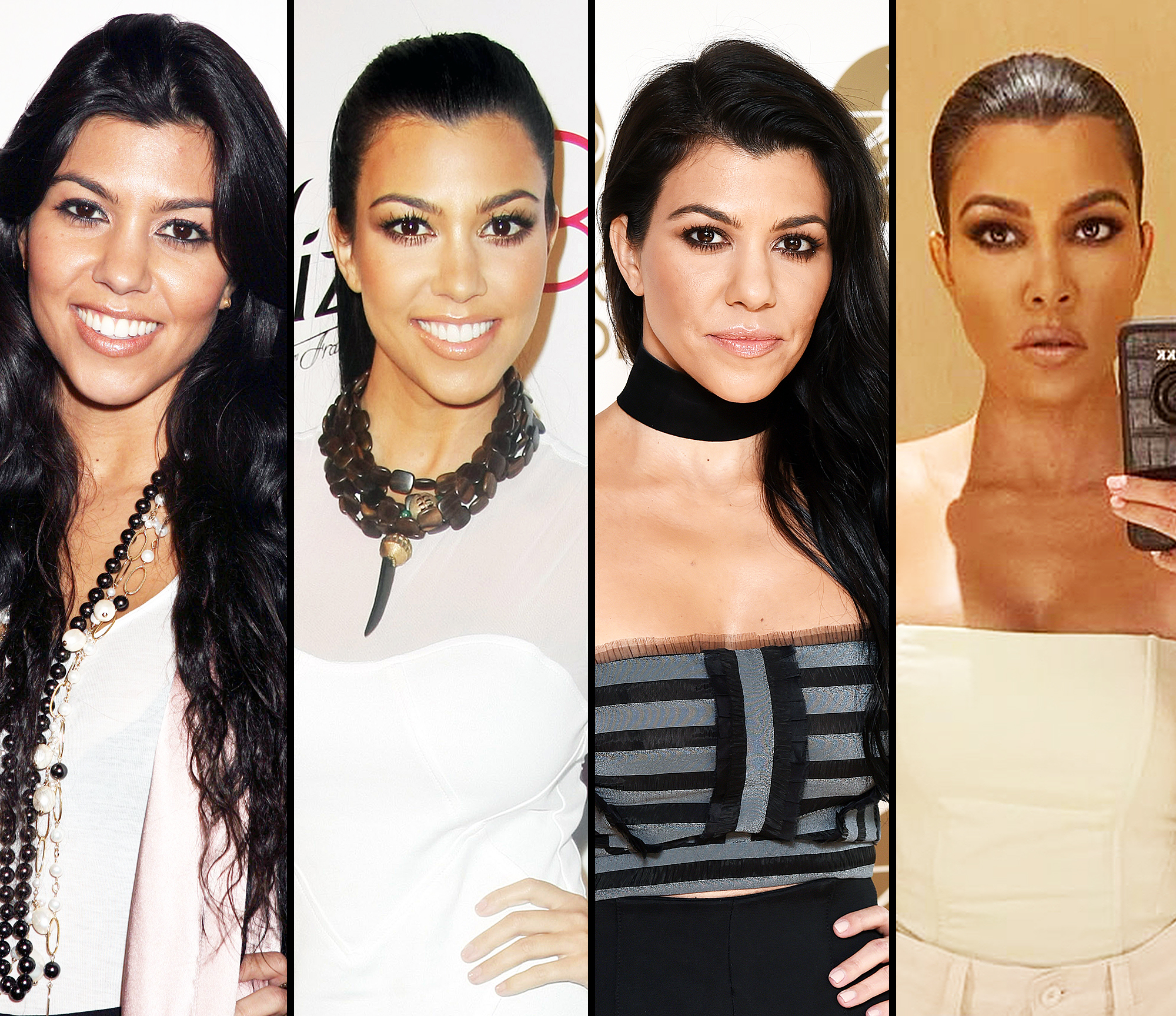 Kim Kardashian Plastic Surgery Revealed Before After - vrogue.co