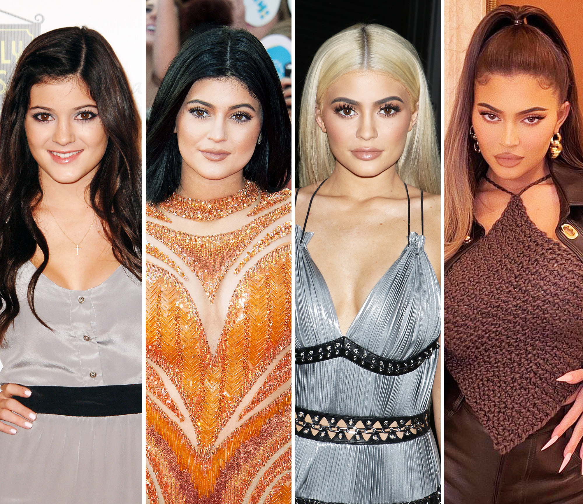 Kardashian Jenners Plastic Surgery Before And After Photos 5802