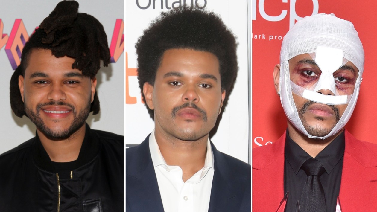 The Weeknd Transformation Music Videos, Plastic Surgery and More