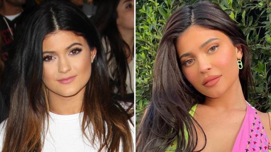 Kylie Jenner Transformation Photos See How She S Changed