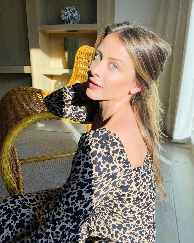 'Laguna Beach' Alum Lo Bosworth Details Living With a Traumatic Brain Injury After 2019 Accident
