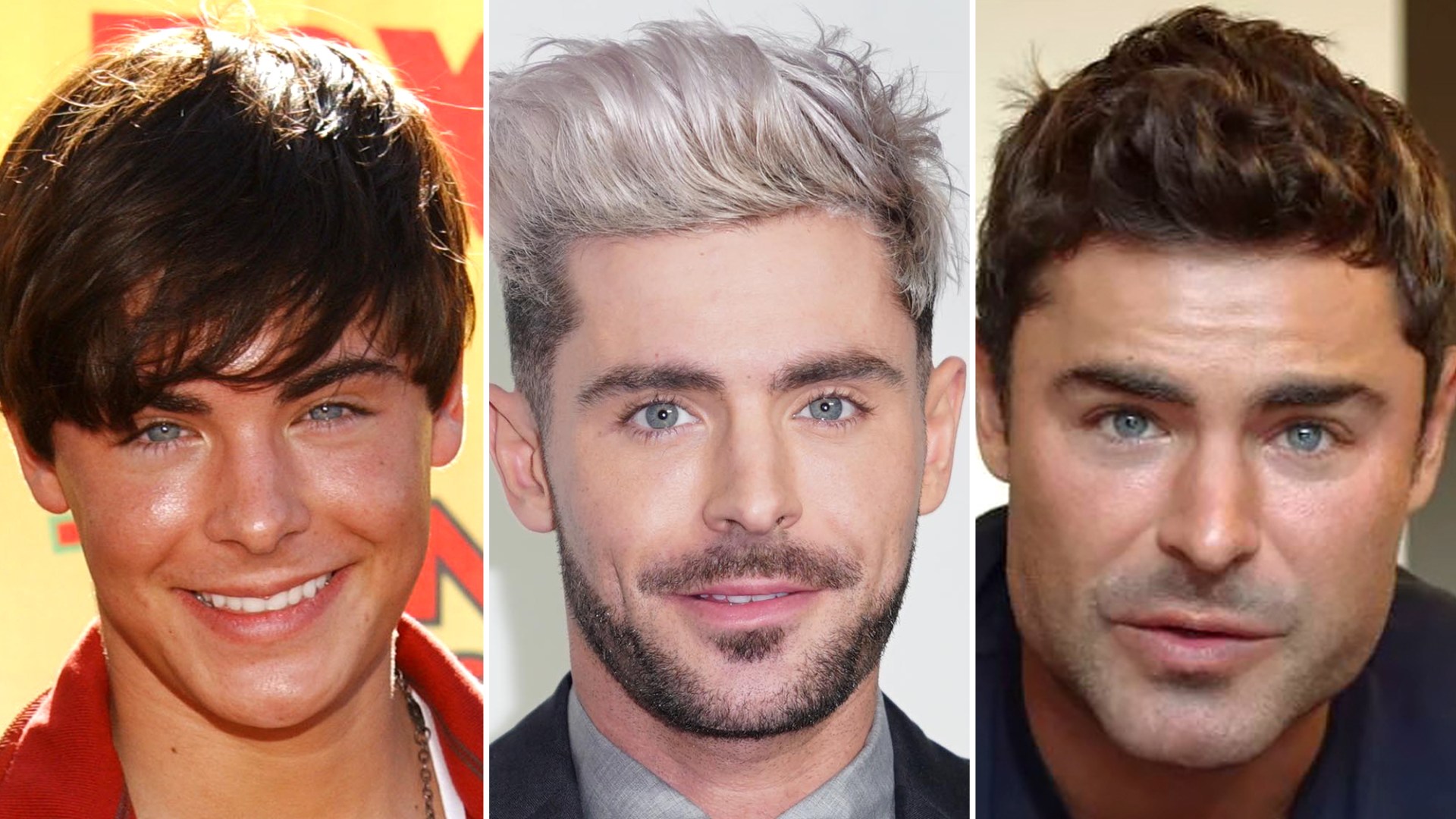 zac efron accident face surgery        <h3 class=