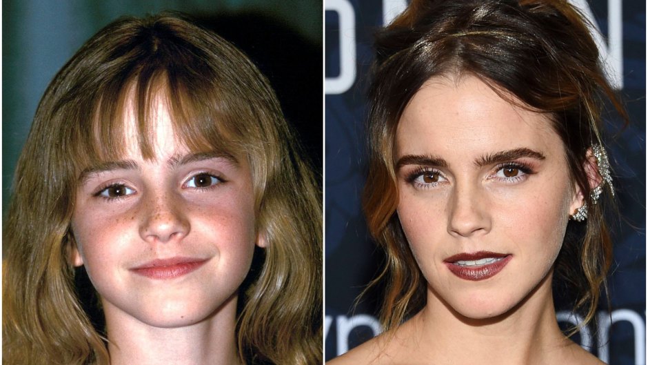 940px x 529px - Emma Watson Transformation: From 'Harry Potter' to Now