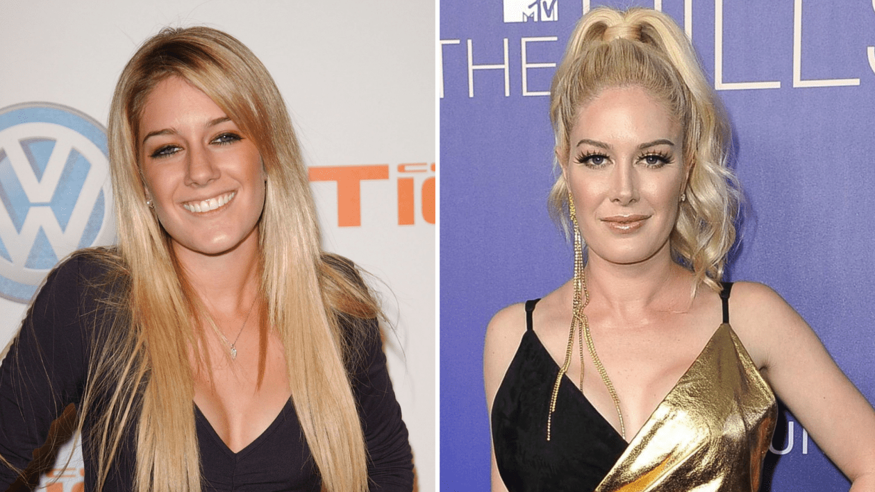 Heidi Montag Plastic Surgery Photos of Her Before and After