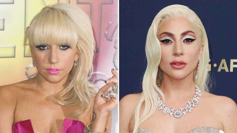 Lady Gaga Weight Loss Transformation Before After Photos Life And Style