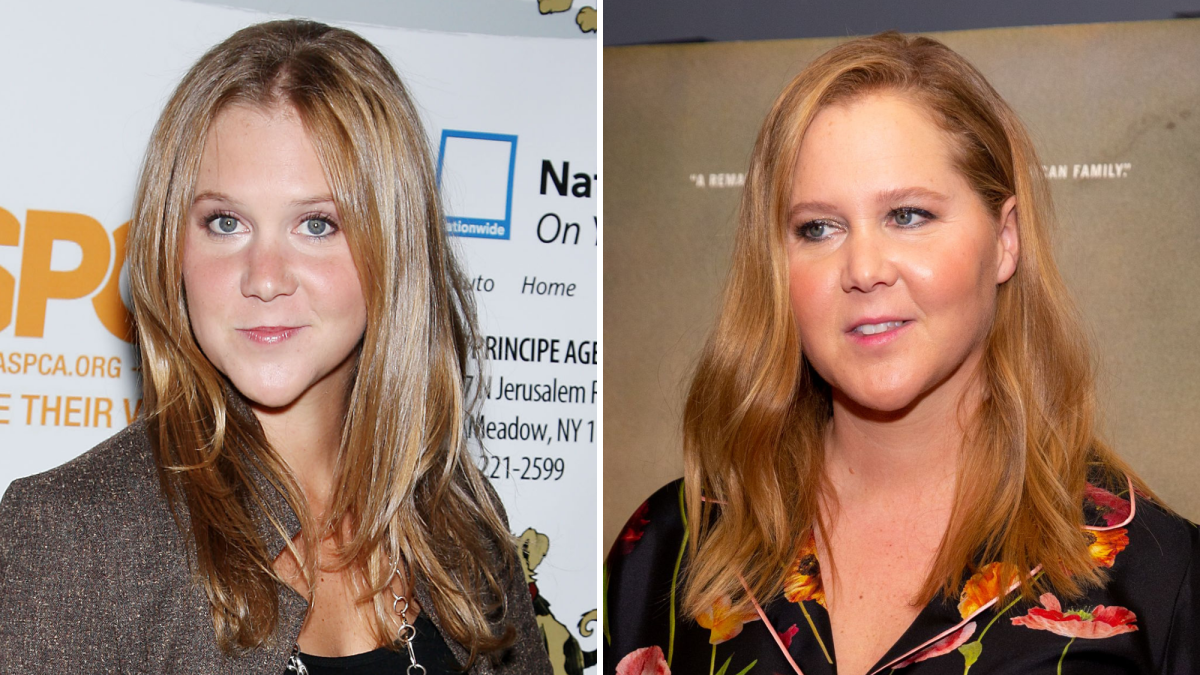 1200px x 675px - Did Amy Schumer Get Plastic Surgery? Transformation Photos