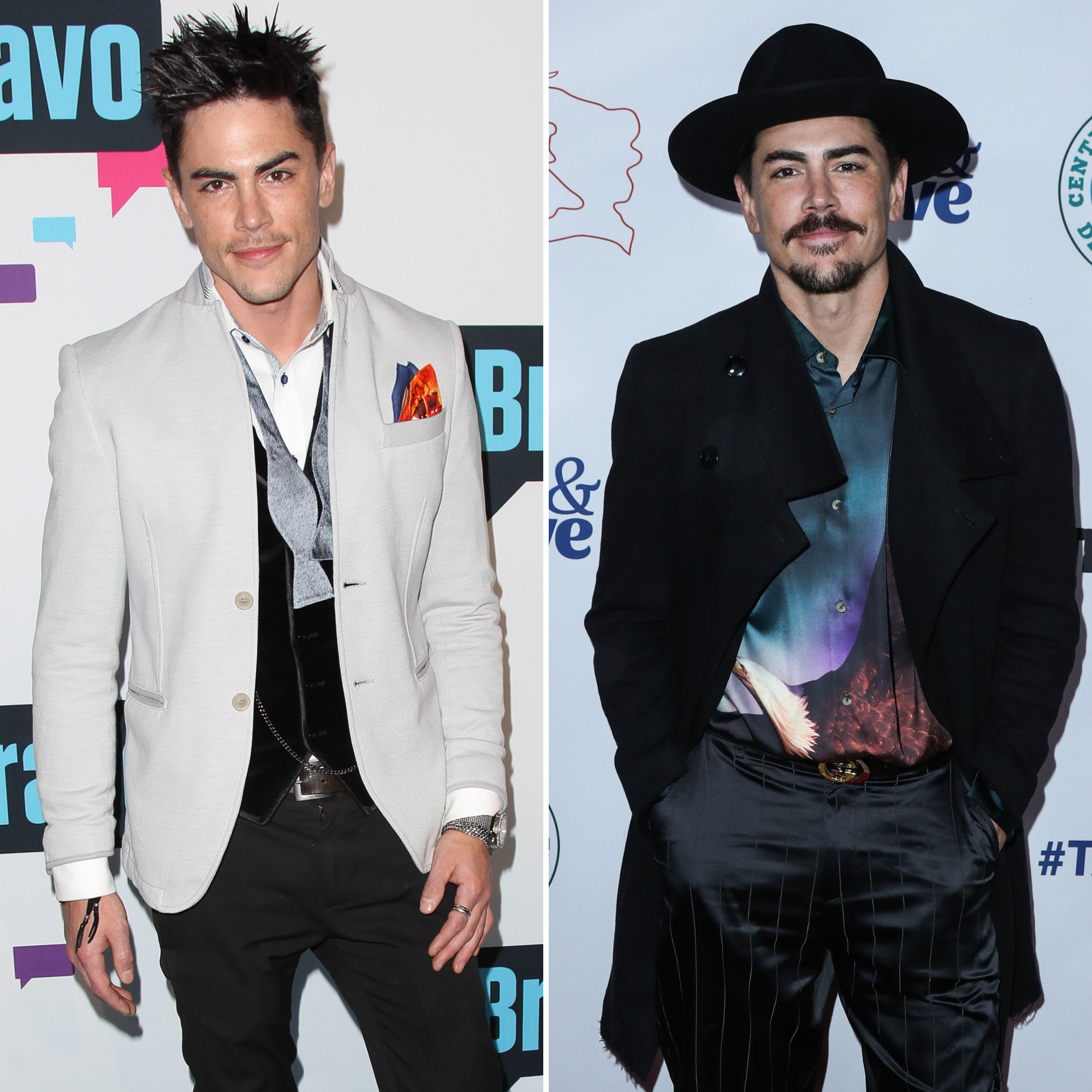 ‘Vanderpump Rules’ Cast Then vs Now Transformation Photos Life & Style