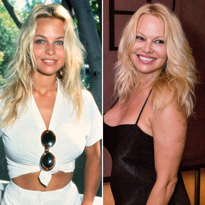 Did Pamela Anderson Get Plastic Surgery? Quotes, Photos