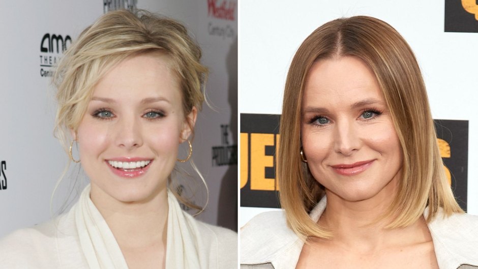 940px x 529px - Did Kristen Bell Get Plastic Surgery? Her Transformation Photos