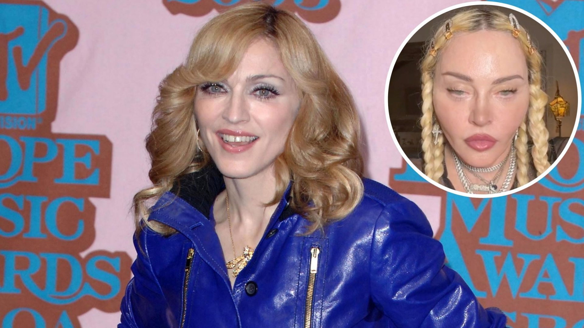 Madonna Transformation and Plastic Surgery Speculation Photos