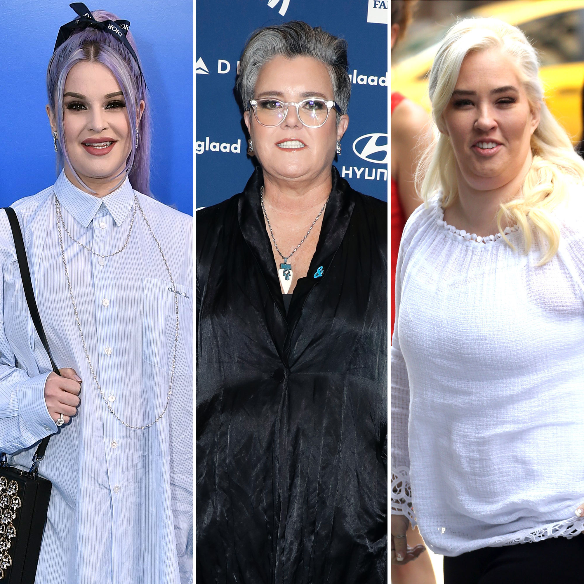 10 Celebrities Who Had Liposuction - Memorial Plastic Surgery