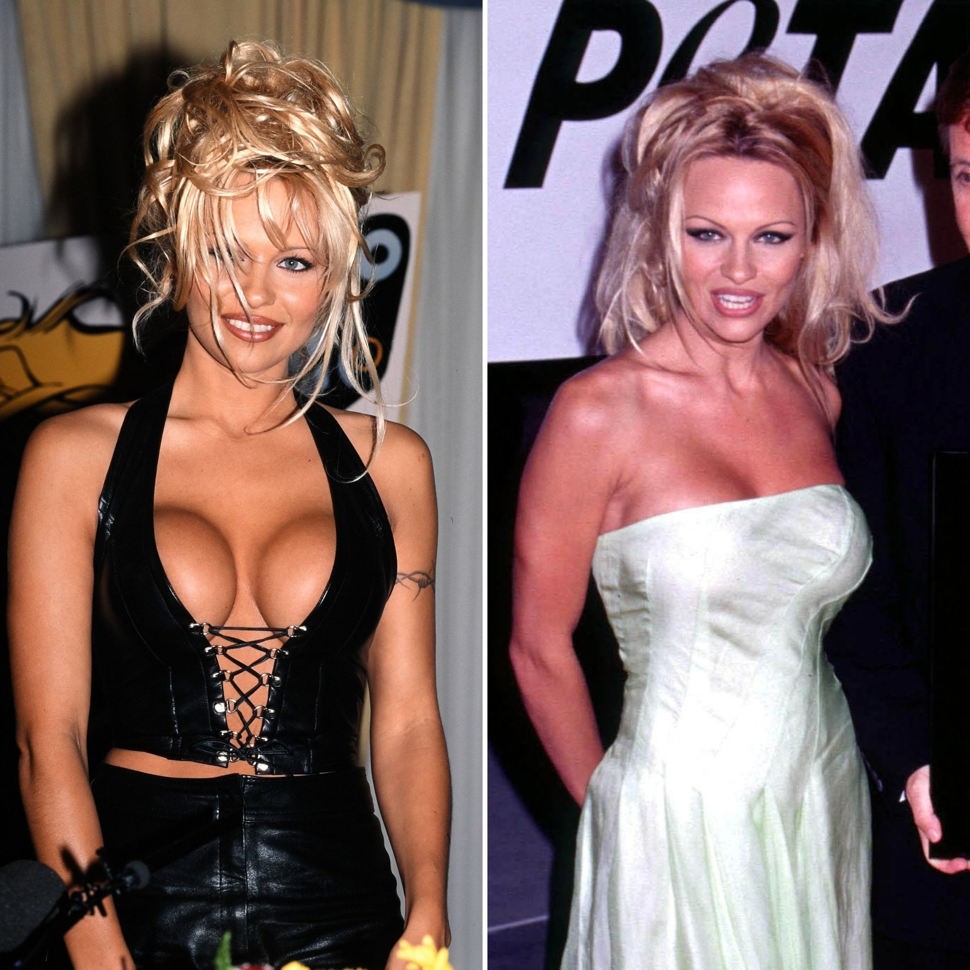 Celebs Who Had Breast Implants Removed Before After Photos