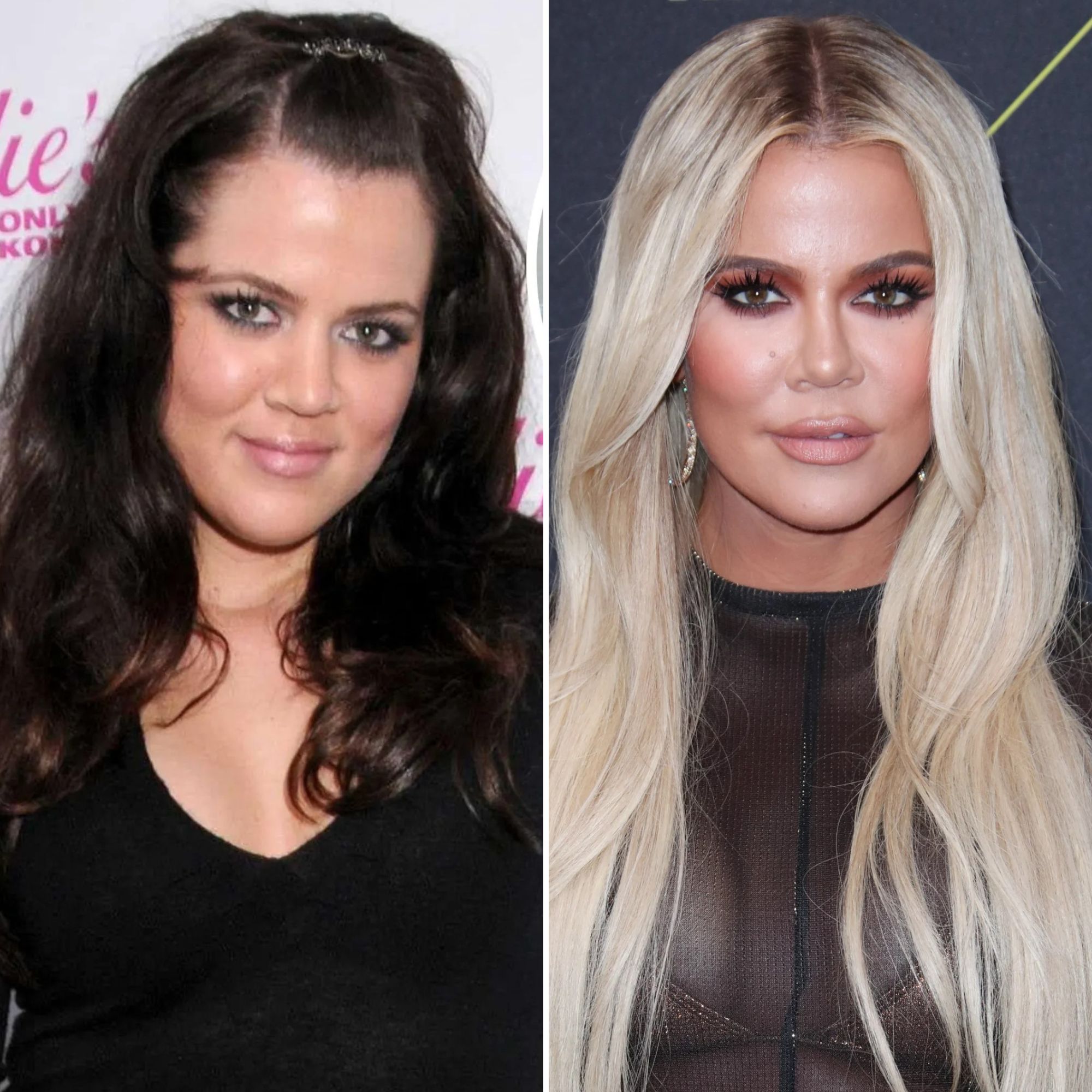 Khloe Kardashian Plastic Surgery Before After Photos   Khloe Kardashians Plastic Surgery Transformation Photos 