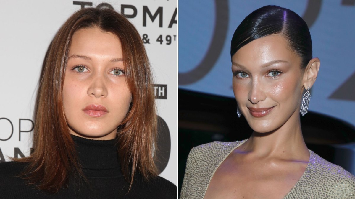 Did Bella Hadid Get Plastic Surgery Transformation Photos Life And Style