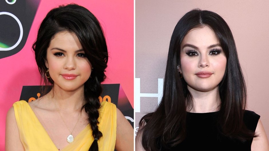 selena gomez plastic surgery before and after lips
