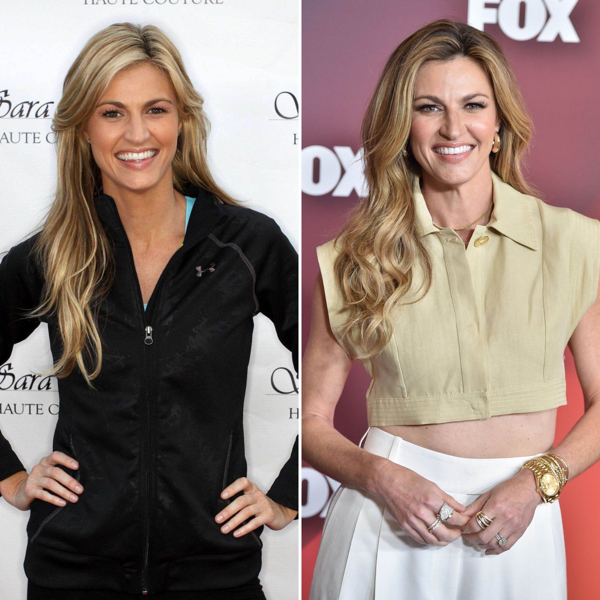 Has Erin Andrews Had Plastic Surgery Her Transformation Photos