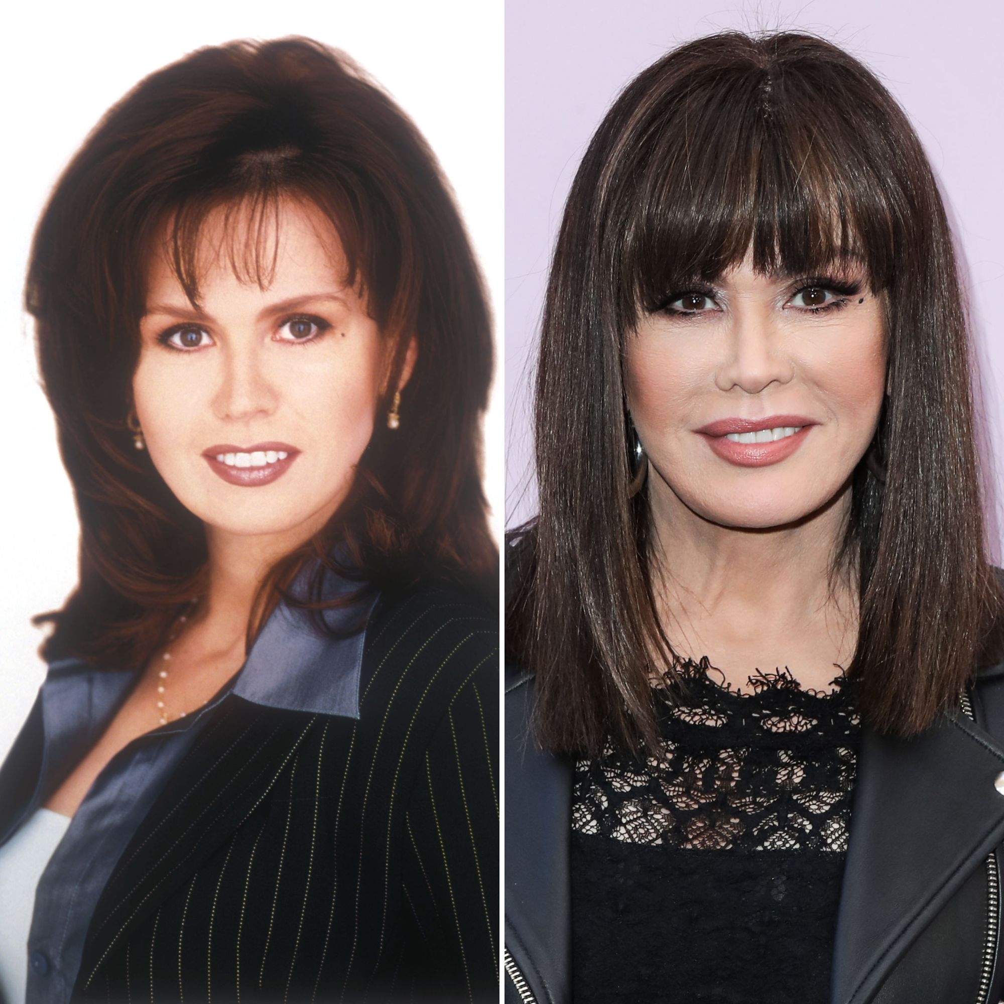 Did Marie Osmond Get Plastic Surgery Transformation Photos Life