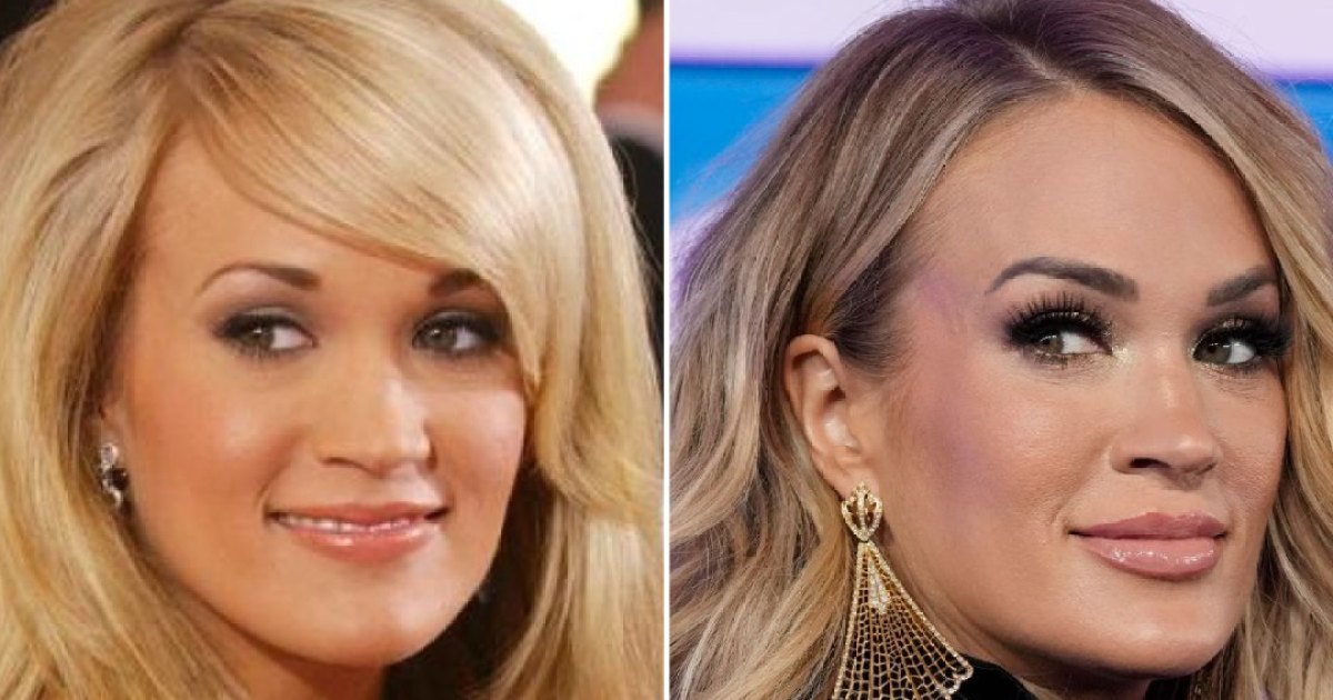 1200px x 630px - Did Carrie Underwood Get Plastic Surgery? Photos Then, Now