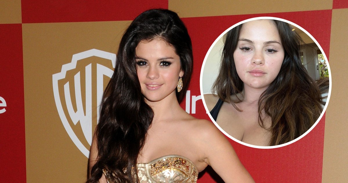 Lesbo Porn Selena Gomez - Did Selena Gomez Get Plastic Surgery? Inside Rumors