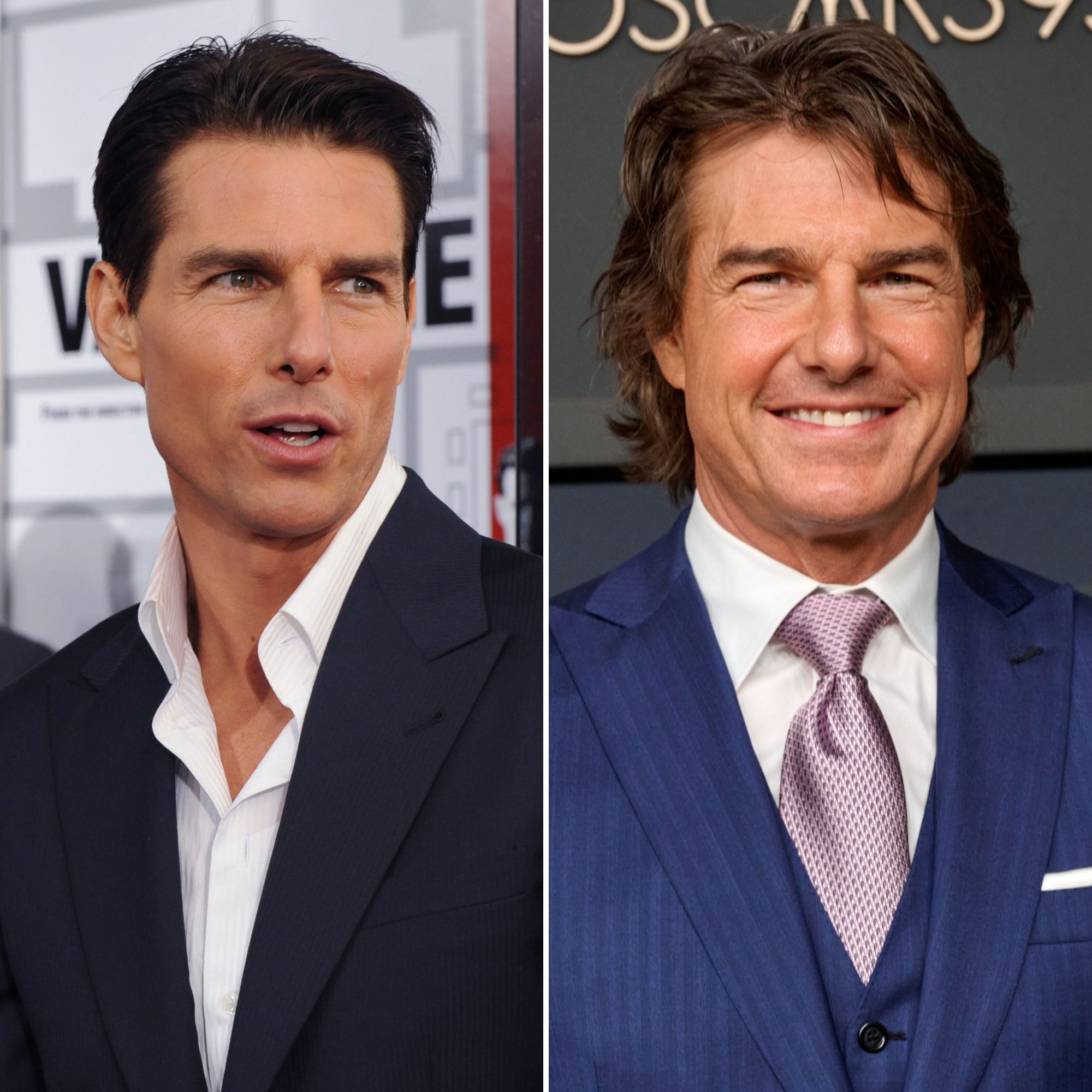 Did Tom Cruise Get Plastic Surgery Photos of His Transformation