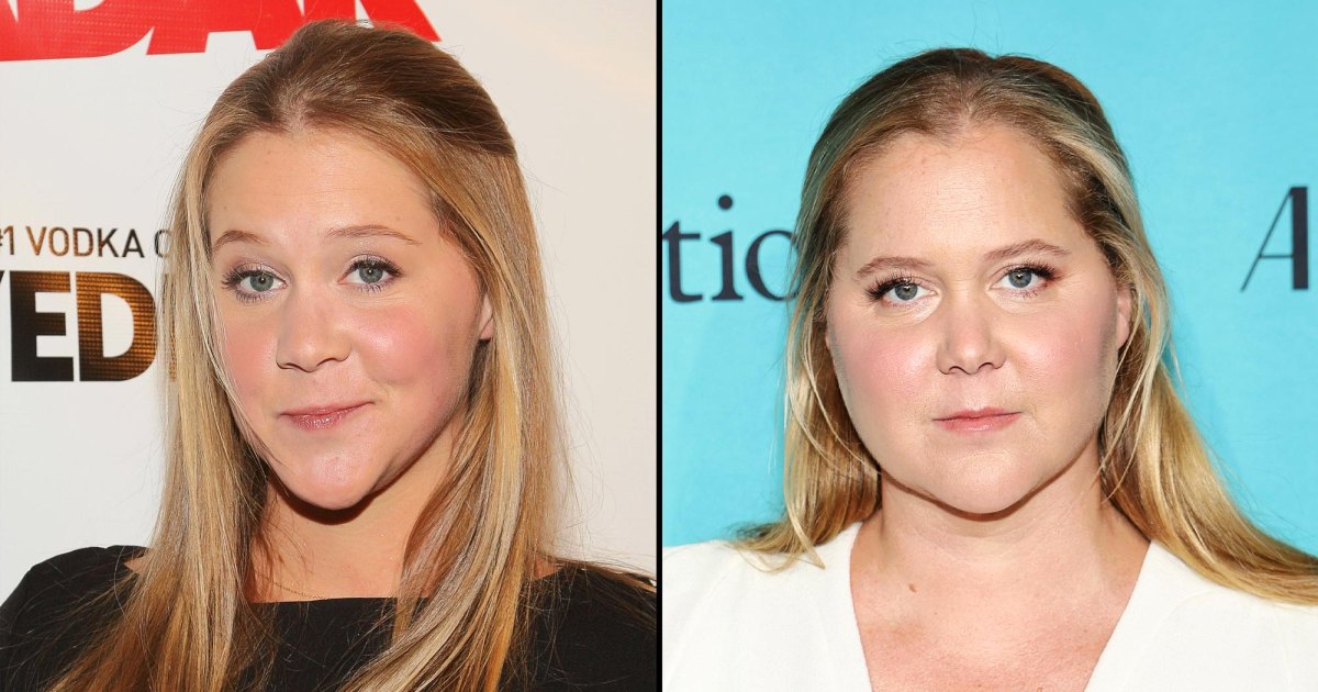 1200px x 630px - Did Amy Schumer Get Plastic Surgery? Transformation Photos | Life & Style