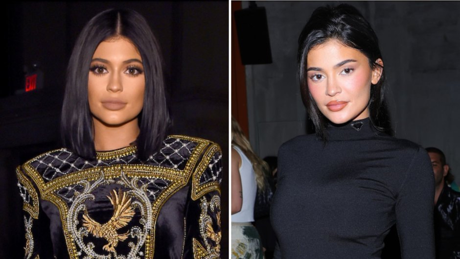 Kylie Jenner Says She Dissolved 'Half' of Her Lip Filler