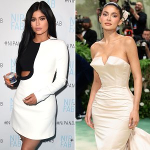 Kylie Jenner ‘Worries’ She’s Gone Too Far With Surgery